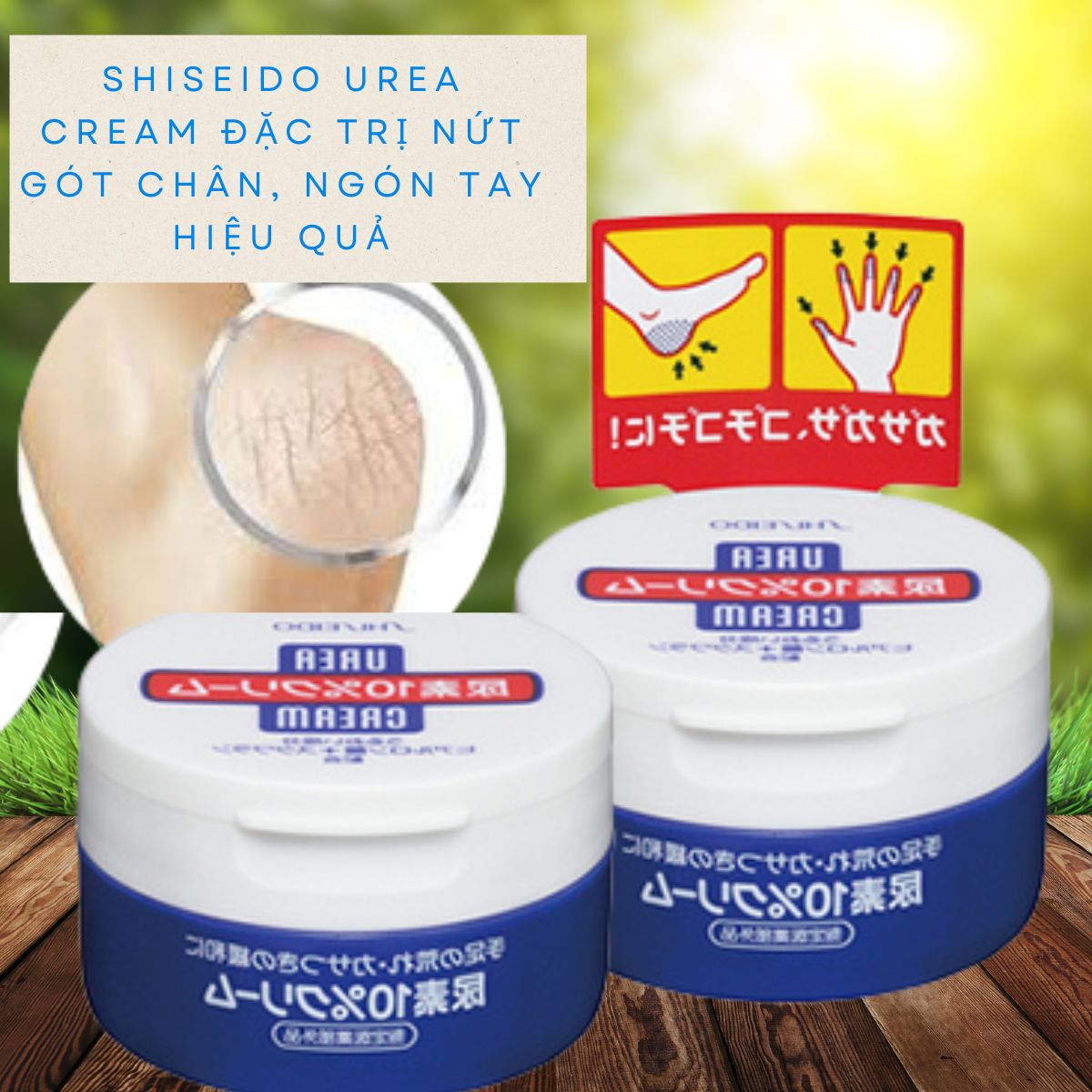 Kem Trị Nứt Gót Chân, Ngón Tay Shiseido UREA Cream - 100gr